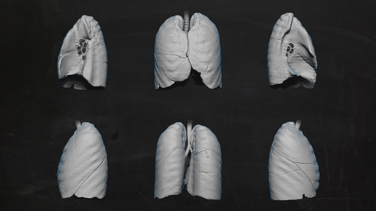 3D-Illustration: 6 Ansichten einer farblosen menschlichen Lunge vor schwarzem Grund