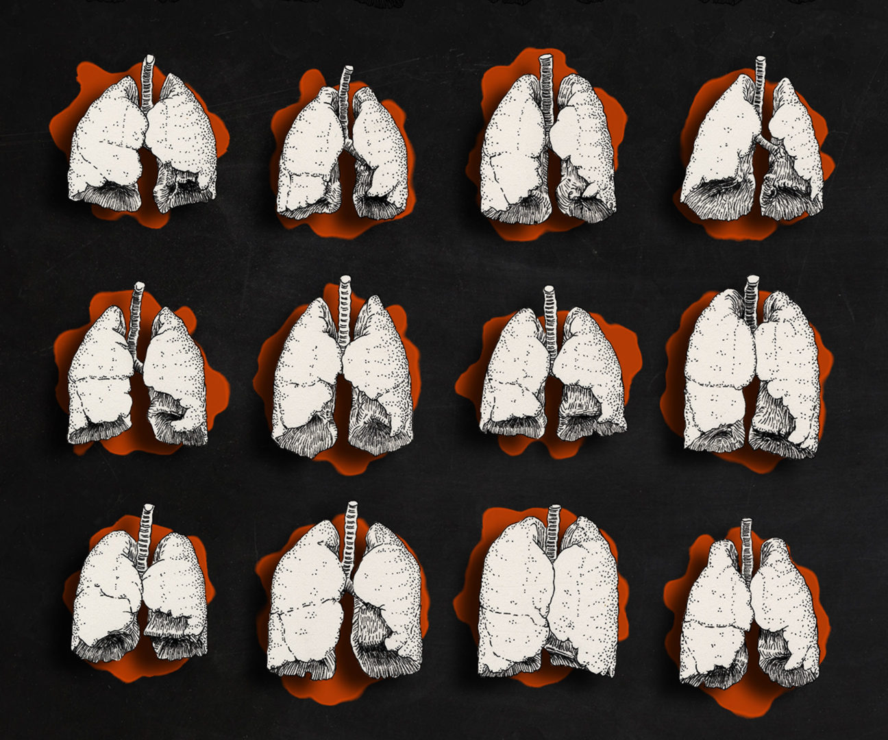 Illustration: Strichzeichung von 12 unterschiedliche menschliche Lungen in Frontalansicht